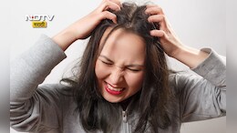 Winter Hair Care Tips: हिवाळ्यात डोक्याला येणाऱ्या खाजेमुळे त्रस्त आहात? करा हे 5 उपाय