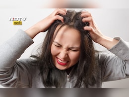 Winter Hair Care Tips: हिवाळ्यात डोक्याला येणाऱ्या खाजेमुळे त्रस्त आहात? करा हे 5 उपाय
