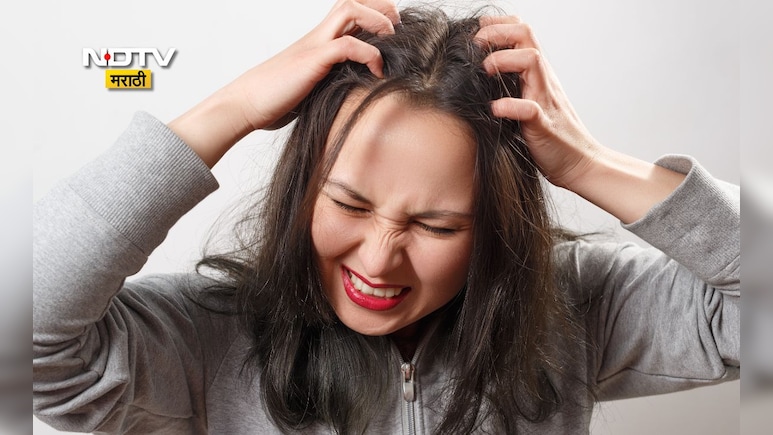 Winter Hair Care Tips: हिवाळ्यात डोक्याला येणाऱ्या खाजेमुळे त्रस्त आहात? करा हे 5 उपाय