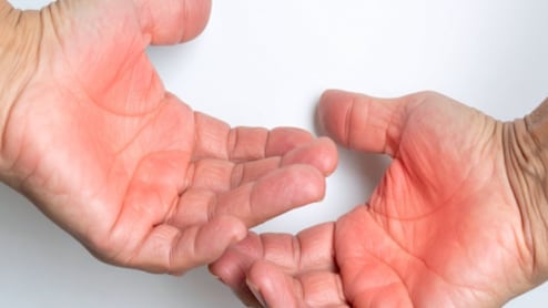 जलने से होने वाले जख्म पर क्या लगाएं? तुरंत राहत देंगे ये 4 घरेलू नुस्खे, त्वचा पर नहीं पड़ेगा दाग