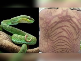 ये चीज लगाकर सो गई लड़की, सोकर उठी तो बन गई नागिन! पीठ की लकीरें देख मुंह से निकल गई चीखें