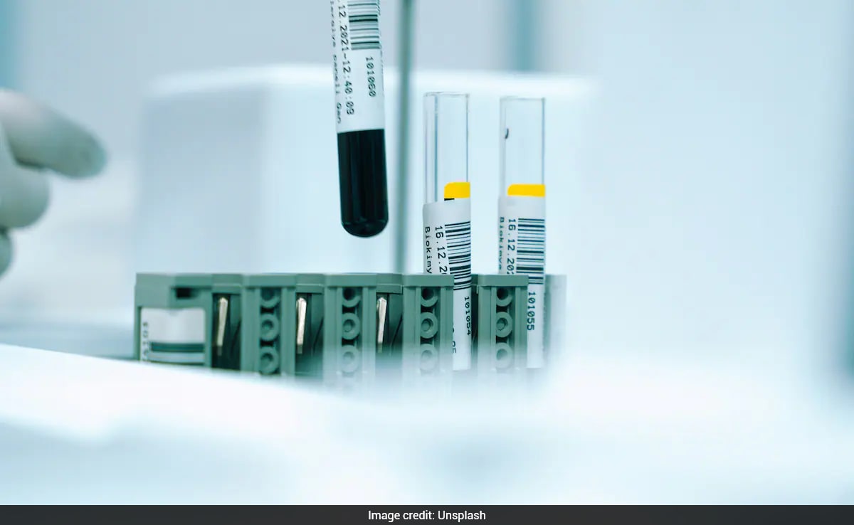 'Golden Blood': All About The Rarest Blood Type Found In Less Than 50 People Worldwide