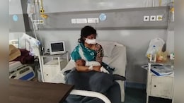 एमपी में पति ने काट दी पत्नी की नाक, फिर खुद ले गया अस्पताल; वजह कर देगी हैरान