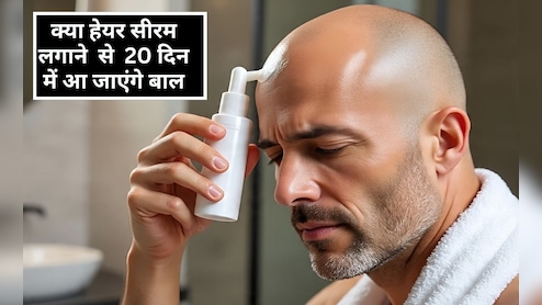 क्या हेयर सीरम बालों को दोबारा उगा सकता है? नई र‍िसर्च का दावा यह हेयर सीरम लगाने पर 20 द‍िन में उग आएंगे बाल