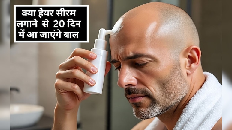 क्या हेयर सीरम बालों को दोबारा उगा सकता है? नई र‍िसर्च का दावा यह हेयर सीरम लगाने पर 20 द‍िन में उग आएंगे बाल