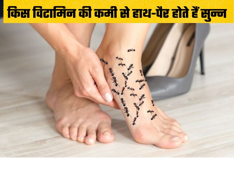 सर्दियों की वजह से नहीं बल्कि इस विटामिन की कमी से हाथ-पैर पड़ते हैं सुन्न? जानिए कैसे करें ठीक