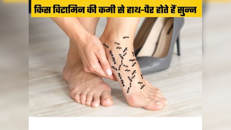 सर्दियों की वजह से नहीं बल्कि इस विटामिन की कमी से हाथ-पैर पड़ते हैं सुन्न? जानिए कैसे करें ठीक