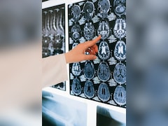 India's Chronic Kidney Disease Cases Hit 138 Million In 2023, 2nd Globally: Study