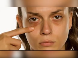 आंखों के नीचे से डार्क सर्कल्स साफ करने के लिए क्या करें? Korean Facial Expert ने बताया सबसे असरदार तरीका