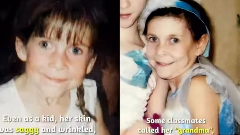 पैदा होते ही बूढ़ी हो गई बच्ची! इस दर्द भरी दासता को सुन कर फट पड़ेगा कलेजा