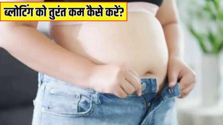 पेट में गैस, फूलना या भारीपन होता है महसूस, तो ये 3 फल करेंगे कमाल, गैस्ट्रोएंटेरोलॉजिस्ट ने बताया ब्लोटिंग की समस्या कैसे मिलेगा छुटकारा