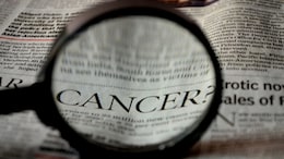 Leukemia, Lymphoma, And Myeloma: Doctor Shares The Differences
