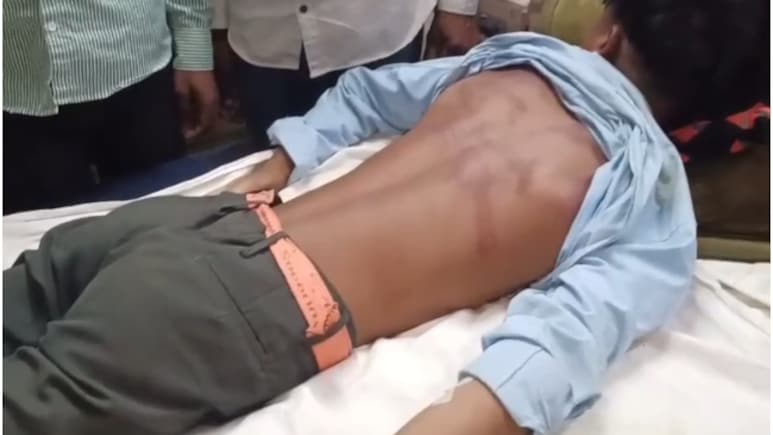 राजस्थान के बांसवाड़ा में 12वीं के छात्र का स्कूल से अपहरण, 4 KM दूर झाड़ियों में गंभीर रूप से घायल मिला