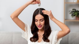Longing For Thicker And More Voluminous Hair? Nutritionist Shares Natural Remedies For Healthy Hair