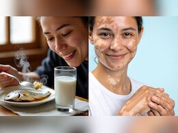 आज का सवाल: क्या सच में दूध और मछली साथ खाने से होता है स्किन पर सफेद दाग वाला रोग विटिलिगो?