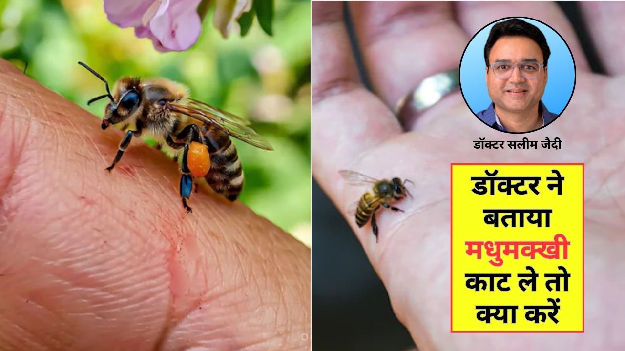 मधुमक्खी-ततैया काट ले तो क्या करें? आयुर्वेदिक डॉक्टर ने बताए 3 सबसे असरदार घरेलू नुस्खे, अभी जान लें आप