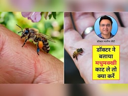 मधुमक्खी-ततैया काट ले तो क्या करें? आयुर्वेदिक डॉक्टर ने बताए 3 सबसे असरदार घरेलू नुस्खे, अभी जान लें आप
