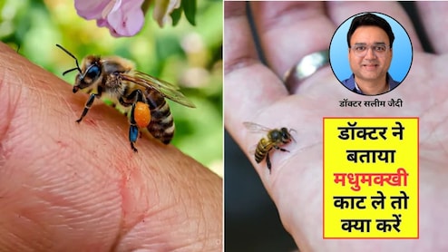 मधुमक्खी-ततैया काट ले तो क्या करें? आयुर्वेदिक डॉक्टर ने बताए 3 सबसे असरदार घरेलू नुस्खे, अभी जान लें आप