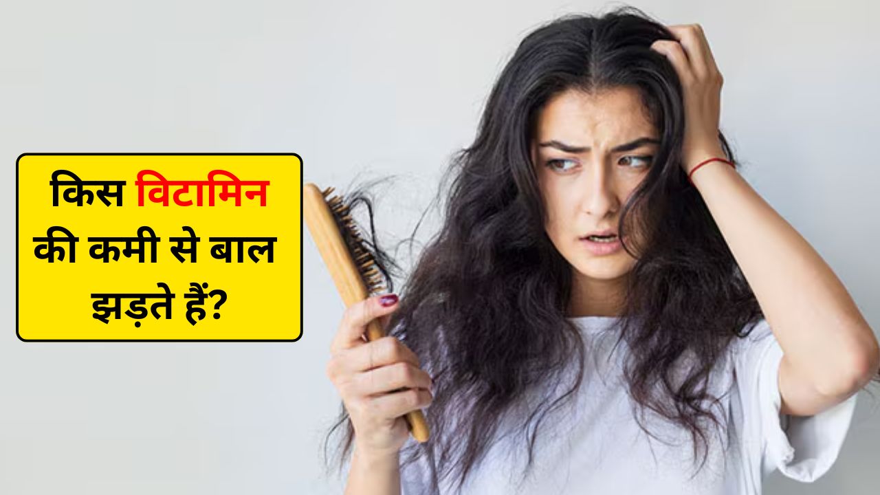 कौन से विटामिन की कमी से बाल झड़ते हैं? जानिए कौन सा तेल लगाने से बाल झड़ना बंद हो जाता है