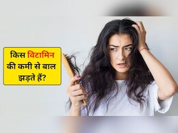 कौन से विटामिन की कमी से बाल झड़ते हैं? जानिए कौन सा तेल लगाने से बाल झड़ना बंद हो जाता है