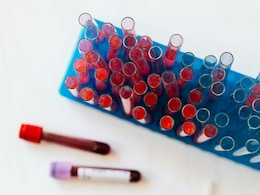 Blood Map Unlocks Tens Of Thousands Of Hidden Disease Links: Study