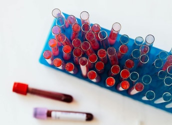 Blood Map Unlocks Tens Of Thousands Of Hidden Disease Links: Study