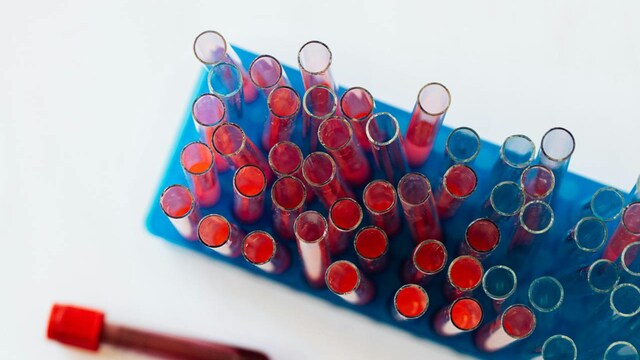 The new blood chemistry atlas marks a major step forward in understanding human health
