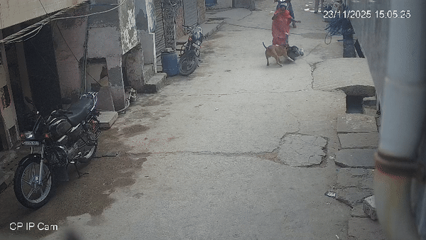 दिल्ली में फिर पिटबुल का आतंक, गली में खेल रहे 6 साल के बच्चे पर हमला कर काट दिया कान