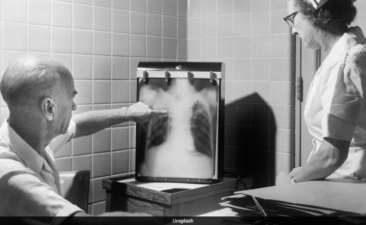 Tuberculosis Bacteria Are Mutating, Turning Antibiotic Resistant: IIT Bombay Study