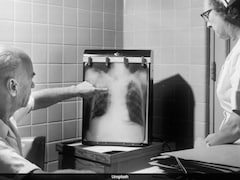 Tuberculosis Bacteria Are Mutating, Turning Antibiotic Resistant: IIT Bombay Study