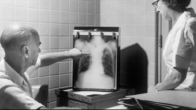 Tuberculosis Bacteria Are Mutating, Turning Antibiotic Resistant: IIT Bombay Study