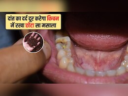 किचन में रखे इस छोटे से मसाले से करें दांत का दर्द ठीक, डॉक्टर ने बताया इस्तेमाल करने का सही तरीका