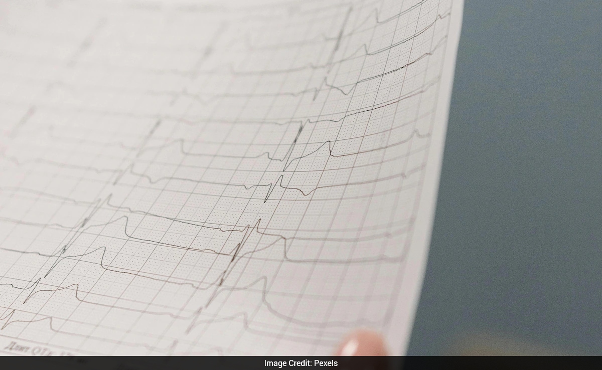 US Hospital Apologises After Mistakenly Declaring Hundreds Of Patient Dead