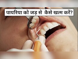 किचन में मौजूद ये चीजें दांतों में लगे पायरिया को जड़ से कर देंगी खत्म, जान लें इस्तेमाल का तरीका