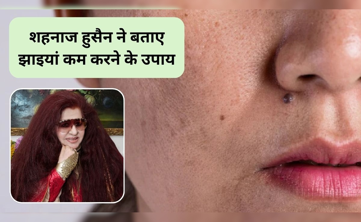 Shahnaz Husain Skin Care Tips: सर्दियों में चेहरे पर झाइयां क्यों बढ़ जाती हैं, इन्हें कम करने के लिए क्या करें? ब्यूटी एक्सपर्ट शहनाज हुसैन ने बताए घरेलू उपाय