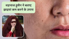 Shahnaz Husain Skin Care: सर्दियों में चेहरे पर झाइयां क्यों बढ़ जाती हैं, इन्हें कम करने के लिए क्या करें