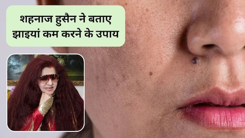 Shahnaz Husain Skin Care Tips: सर्दियों में चेहरे पर झाइयां क्यों बढ़ जाती हैं, इन्हें कम करने के लिए क्या करें? ब्यूटी एक्सपर्ट शहनाज हुसैन ने बताए घरेलू उपाय