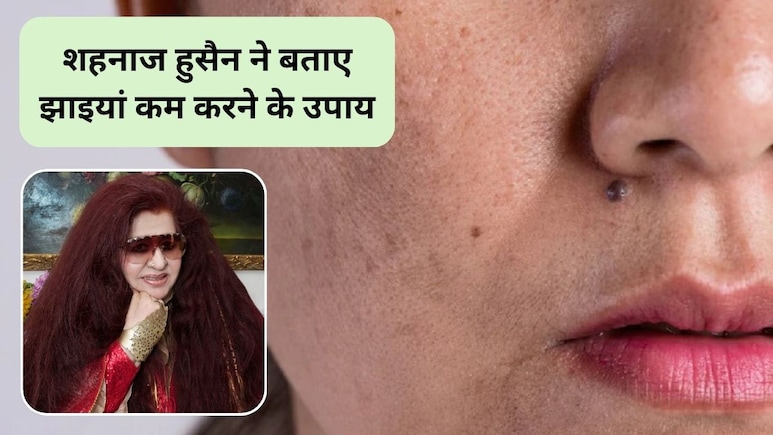 Shahnaz Husain Skin Care Tips: सर्दियों में चेहरे पर झाइयां क्यों बढ़ जाती हैं, इन्हें कम करने के लिए क्या करें? ब्यूटी एक्सपर्ट शहनाज हुसैन ने बताए घरेलू उपाय
