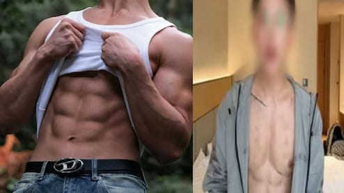 ये तो गजब ही हो गया...बॉडी बनाने के लिए एसिड के इंजेक्शन लगवाता था बंदा, लुटाए 5 करोड़