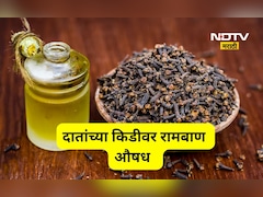 Teeth Cavity: दातातील किडीचा 1 मिनिटात गेम ओव्हर! हे आहेत 4 प्रभावी घरगुती उपाय