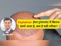 Explainer: हेयर ट्रांसप्लांट के कितने दिन बाद बाल धो सकते हैं? नहीं रखी ये सावधानियां तो ट्रांसप्लांट हो सकता है फेल