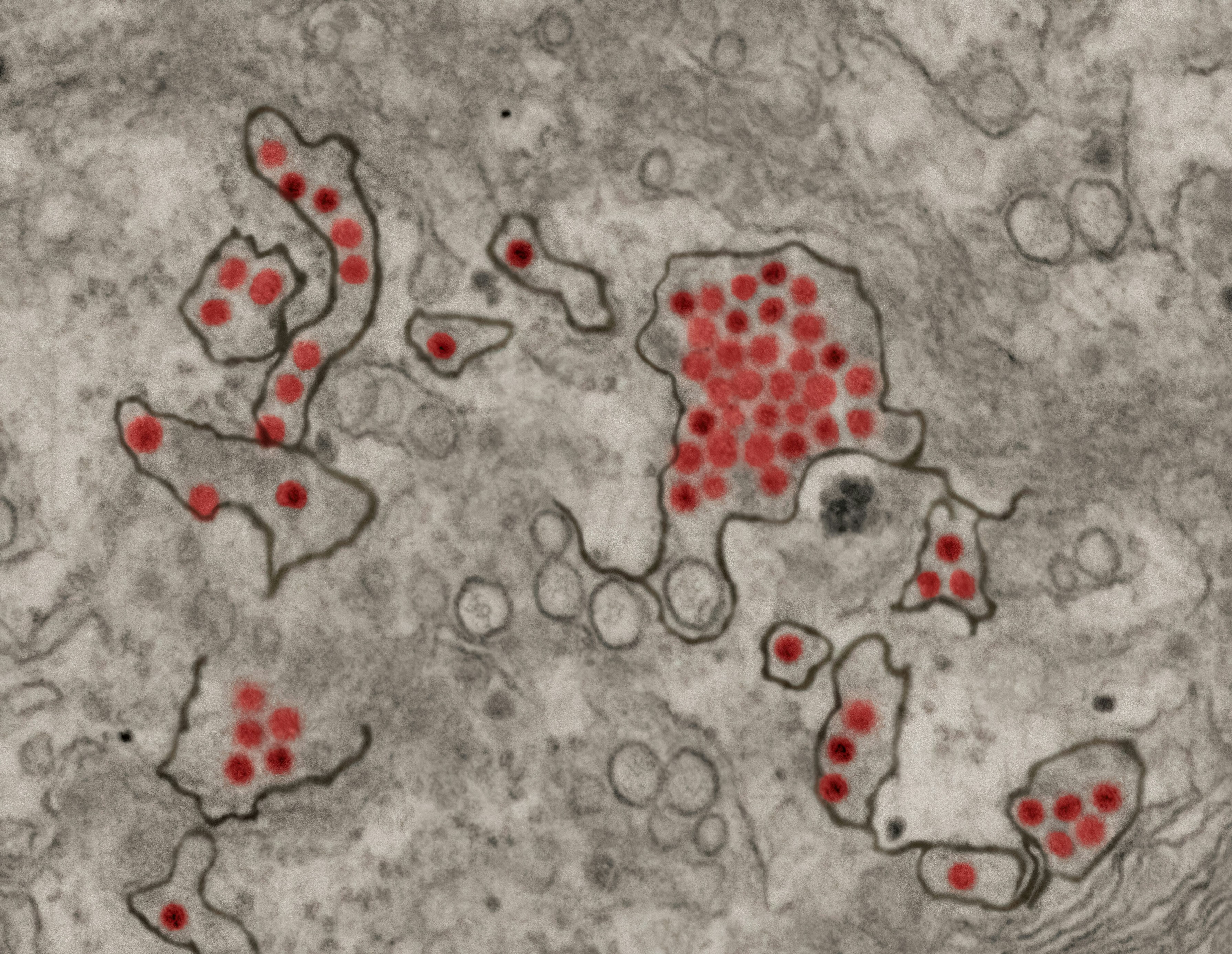 Pune Reports 66 Cases Of Zika Virus Infection Since June
