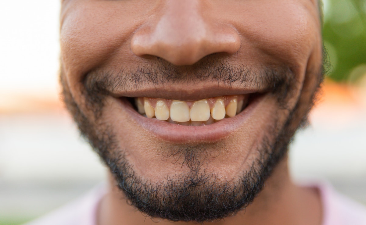 Not Coffee Or Smoking, These 10 Surprising Daily Habits Are Staining Your Teeth