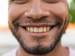 Not Coffee Or Smoking, These 10 Surprising Daily Habits Are Staining Your Teeth