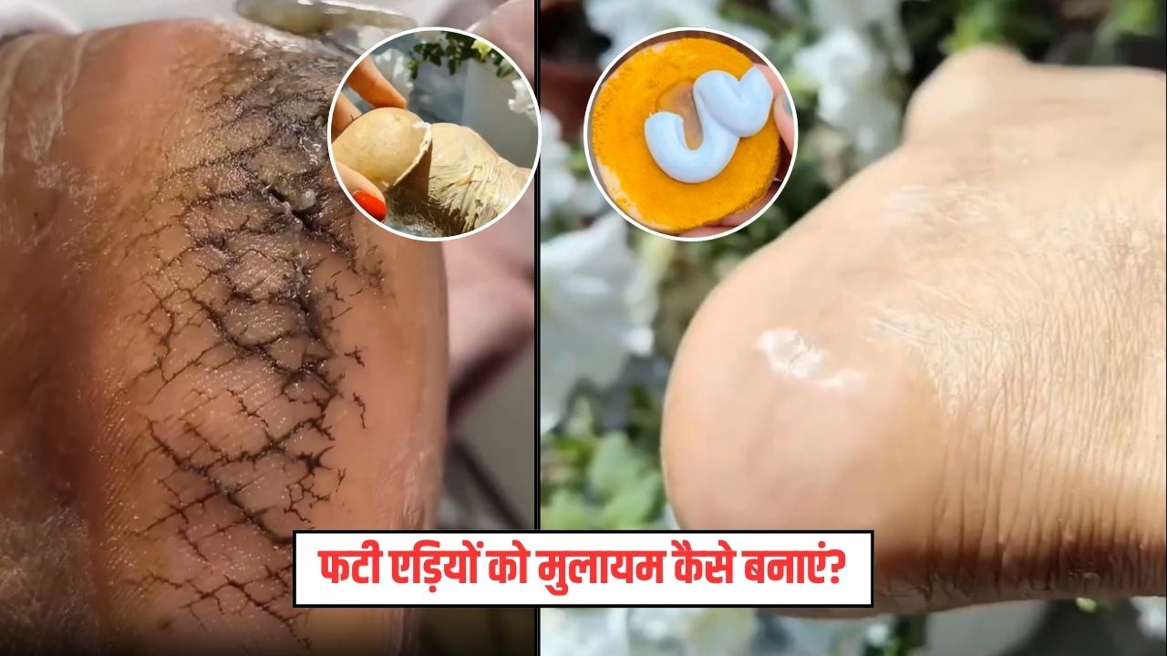 फटी एड़ियों पर रगड़ें आलू के साथ ये 3 चीजें, मुलायम हो जाएगी स्किन, हर कोई पूछेगा राज