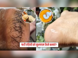 फटी एड़ियों पर रगड़ें आलू के साथ ये 3 चीजें, मुलायम हो जाएगी स्किन, हर कोई पूछेगा राज
