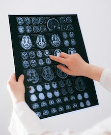 Daily Habits That Boost Your Brain Health