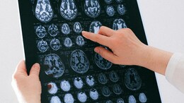 Brain Cells Acting As 'Disappointment Meter' May Help Design New Class Of Drugs, Study Finds