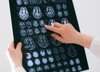 Brain Cells Acting As 'Disappointment Meter' May Help Design New Class Of Drugs, Study Finds