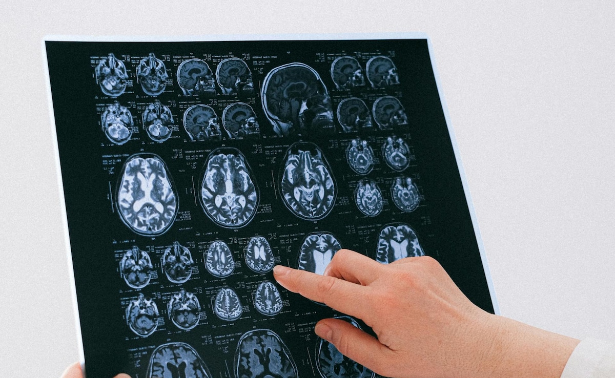 Japanese Researchers Studied How The Brain Adapts To Changing Situations And This Is What They Found